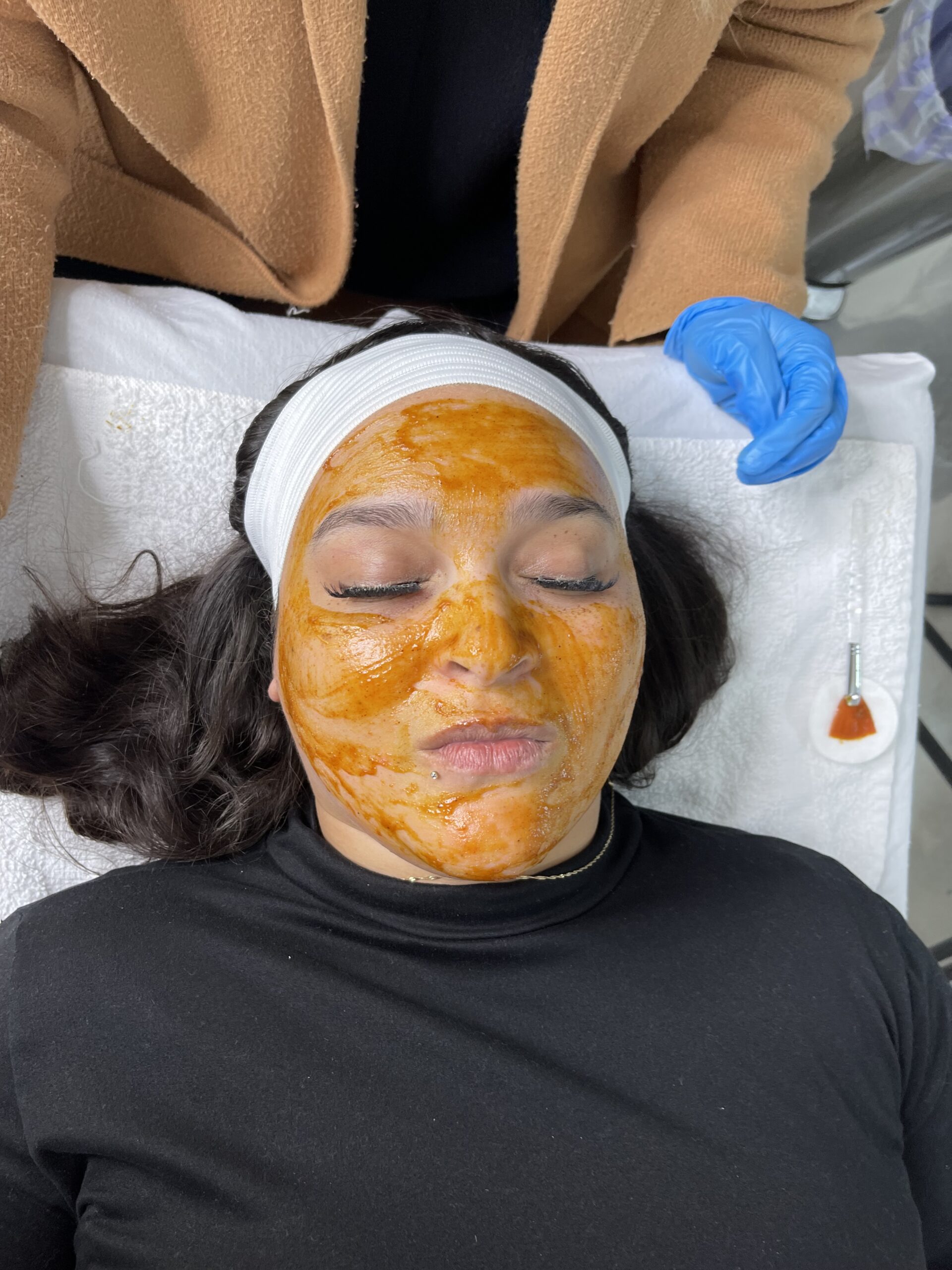 Dermodality Peel Application